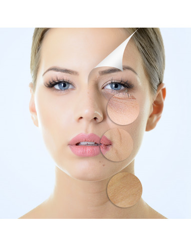 Sérum anti-acné + Dermaroller