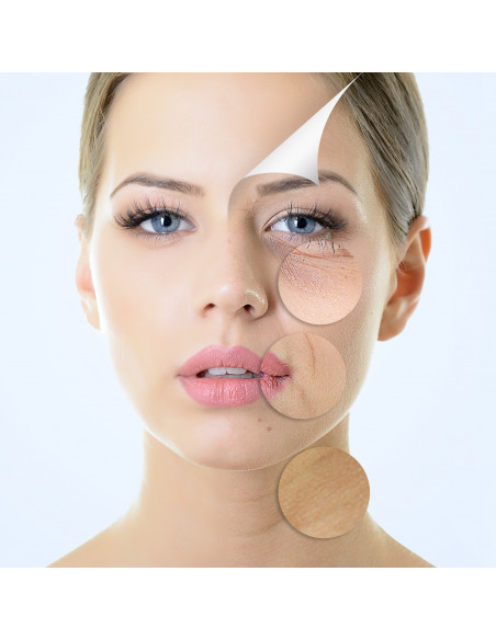 Sérum anti-acné + Dermaroller